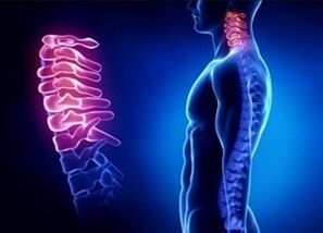 The reasons for the development of cervical osteochondosis